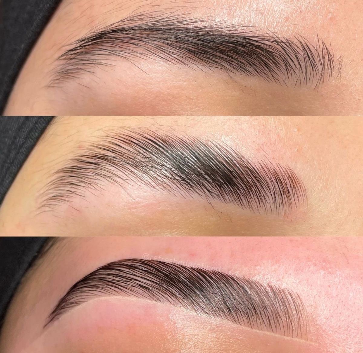 hydrafacial hydrafacial